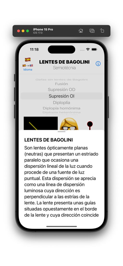 Bagolini Test - A mobile app screen for the Bagolini Test showing a detailed explanation of striated lenses and clinical test options like suppression and diplopia.
