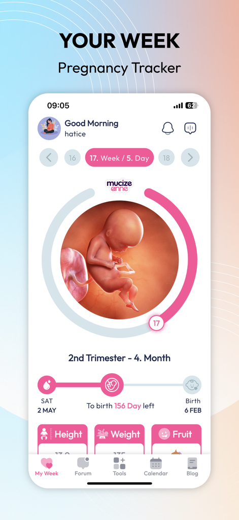 Miracle Mom Pregnancy Tracker - Miracle Mom Pregnancy Tracker app interface showing week 17 of pregnancy with a baby development illustration