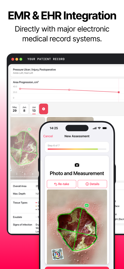 Interface da aplicação WoundGenius que mostra a integração EMR e EHR para sincronização de registos médicos e documentação de feridas.