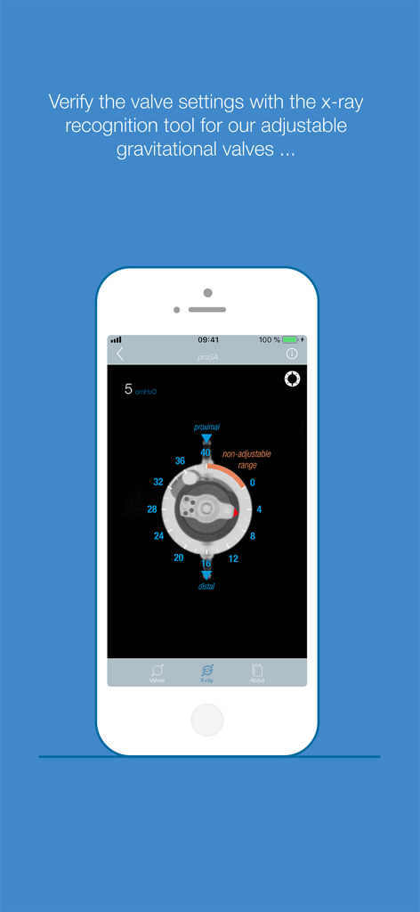 MIETHKE - MIETHKE app interface displaying the X-ray recognition tool used to verify settings on an adjustable gravitational valve