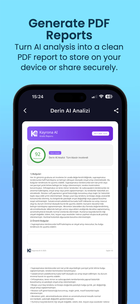 Kayrona DICOM AI Viewer - Interface of the Kayrona app showing a generated medical PDF report from AI analysis on an iPhone.