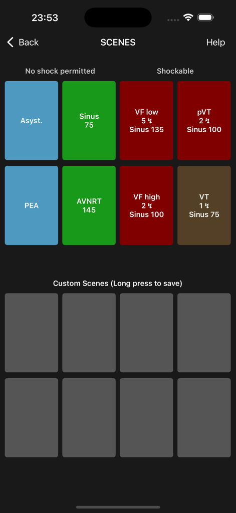 Medical Rescue Sim AED Remote - Schermata delle scene dell'app di simulazione medica che mostra ritmi ECG shockabili e non shockabili per la formazione.