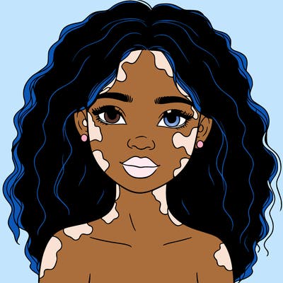 beautiful black girl with vitiligo