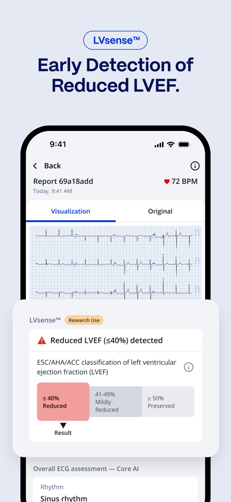 PMcardio app interface demonstrating early detection of reduced LVEF