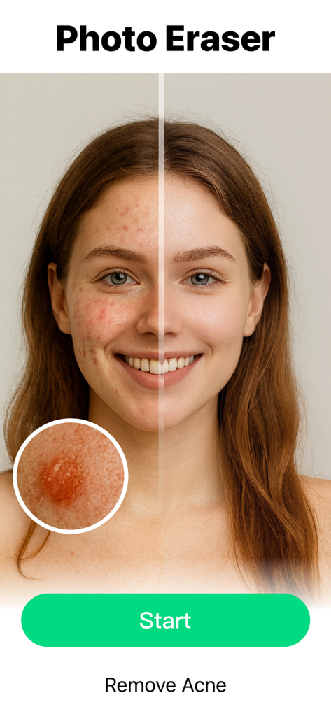Object Removal AI Retouch - Before and after comparison of acne removal on a woman face using AI