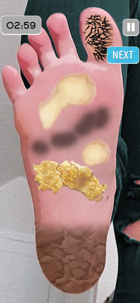 ASMR Foot Care: Doctor Games - A screenshot of ASMR Foot Care Doctor Games showing a foot treatment level.