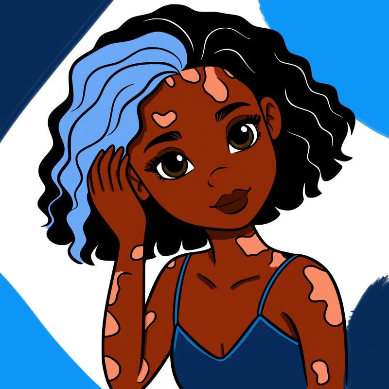 vitiligo black girl