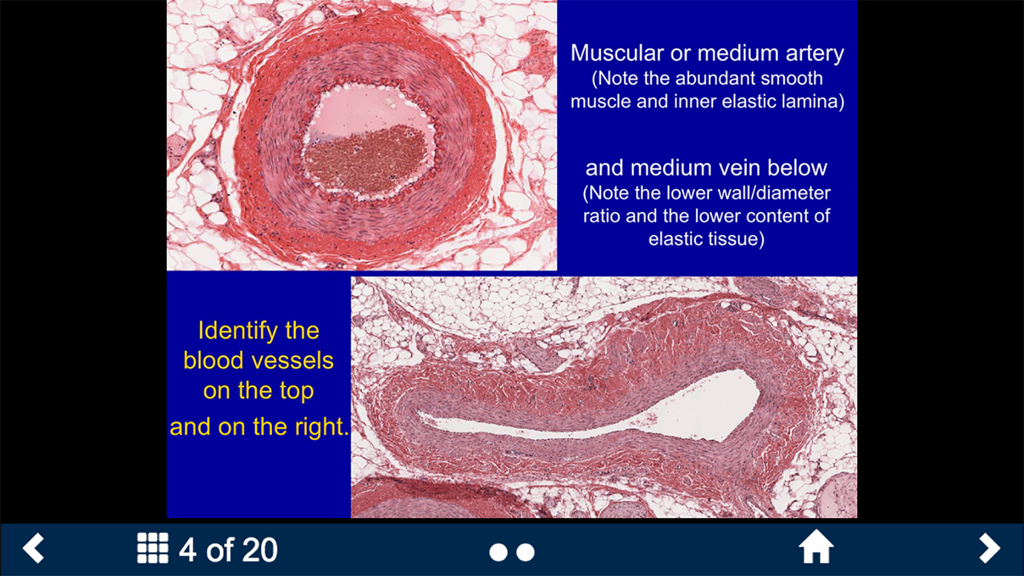 Histology Complete -SecondLook - Micrographs of a muscular artery and a medium vein with anatomical descriptions in the Histology SecondLook app