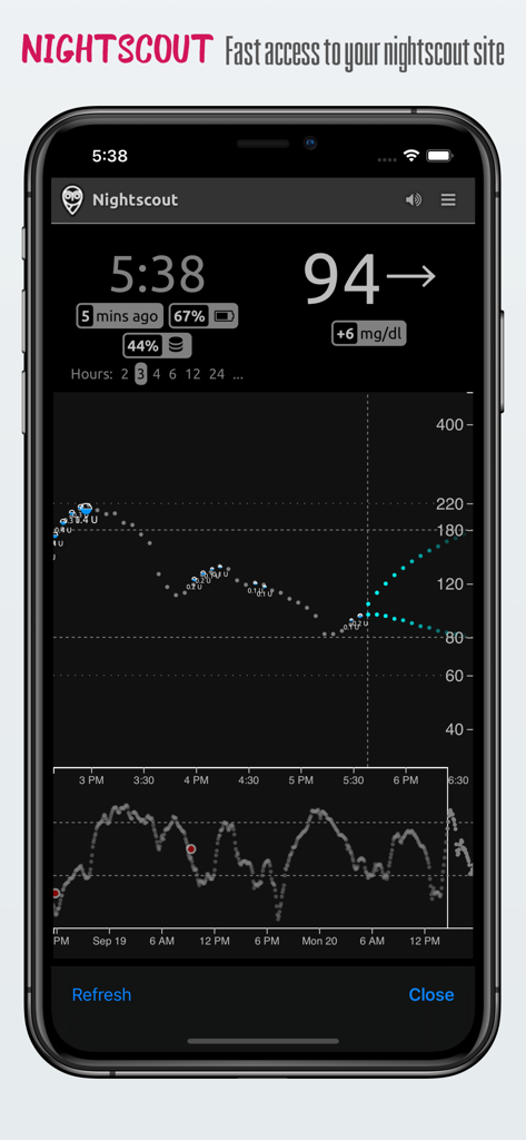 nightguard - iPhone screenshot of Nightguard app displaying blood glucose levels and trend graph