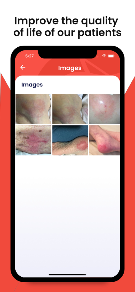 Wound Care Pro - Wound Care Proアプリのスクリーンショット。医学的診断と教育のための臨床創傷画像のライブラリが表示されています。