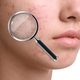 SkinBot AI Skin Care