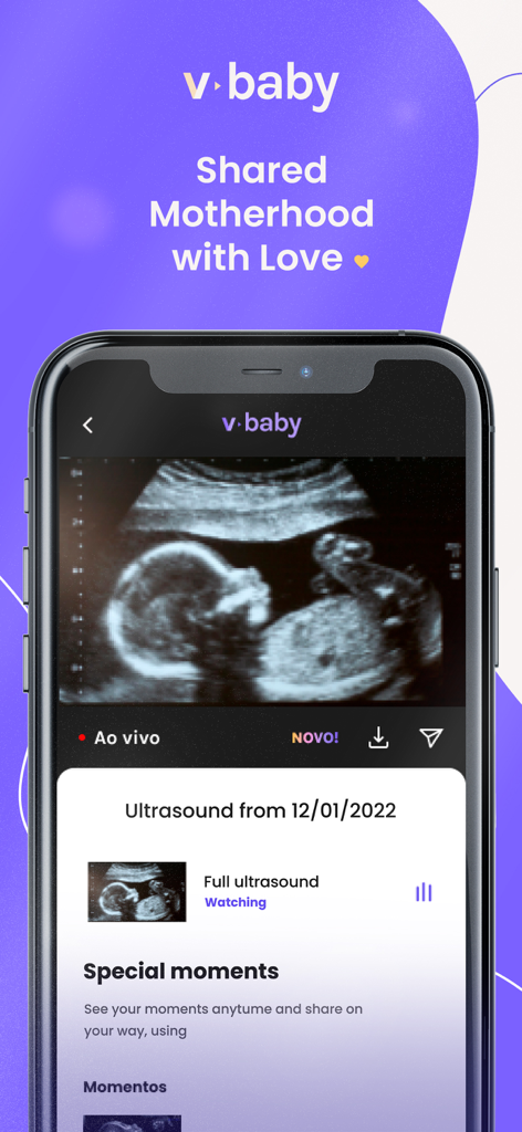 Reproducción de video de ecografía en la interfaz de la aplicación de embarazo V-Baby