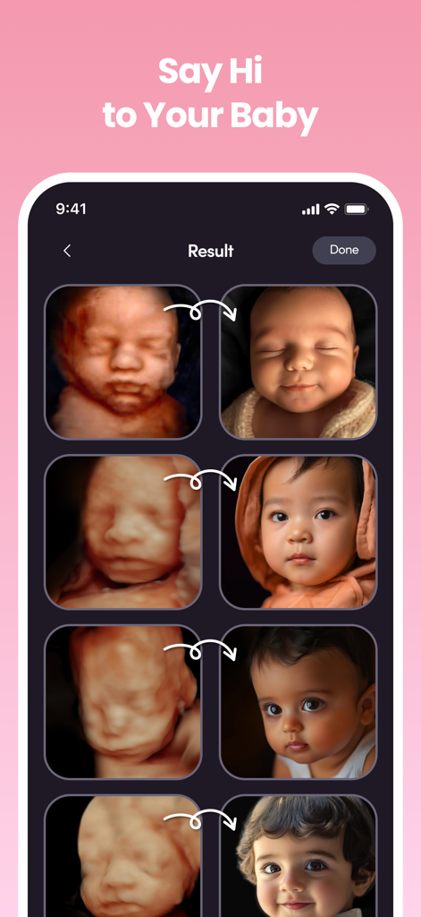 AI-generated realistic baby faces from 3D ultrasound scans in the NubX app.