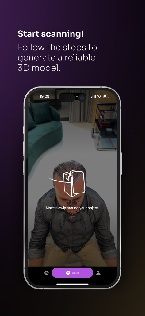 A smartphone screen showing the ScalpScan.AI app interface during a 3D scalp scan process for medical hair restoration planning.