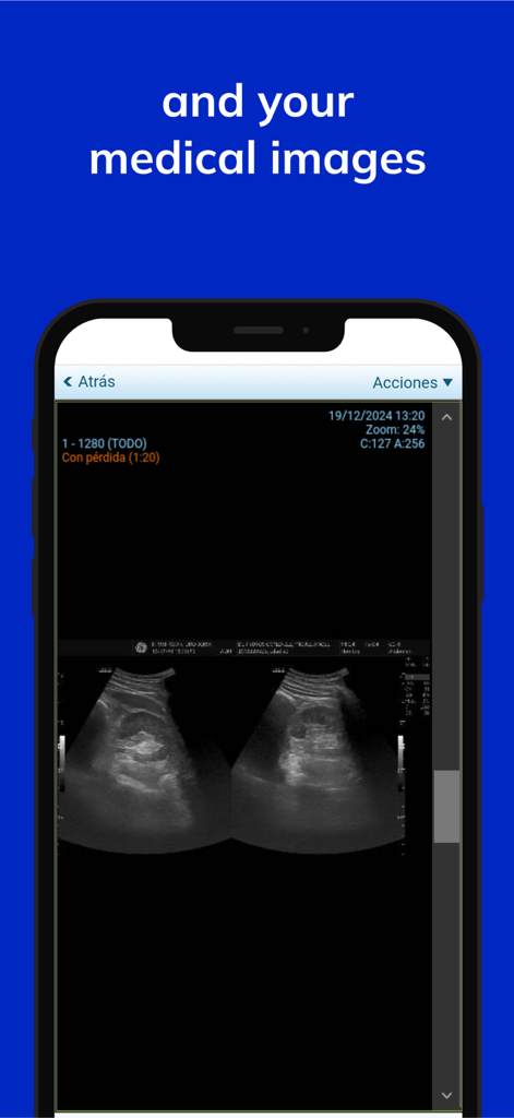 Smartphone exibindo imagens de ultrassom médico no aplicativo Vithas