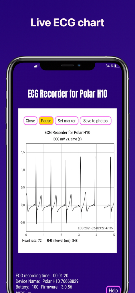 ECG Recorder for Polar H10 - Live ECG waveform chart and heart rate data on a smartphone screen from the ECG Recorder for Polar H10 app