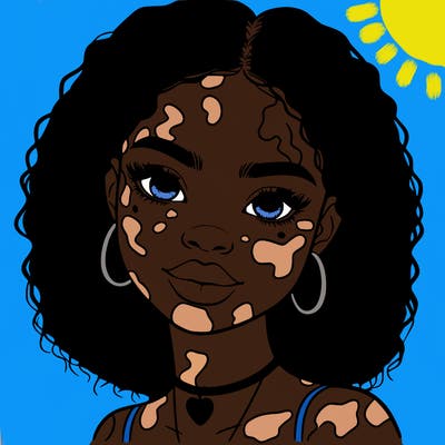 bleautiful black girl with vitiligo