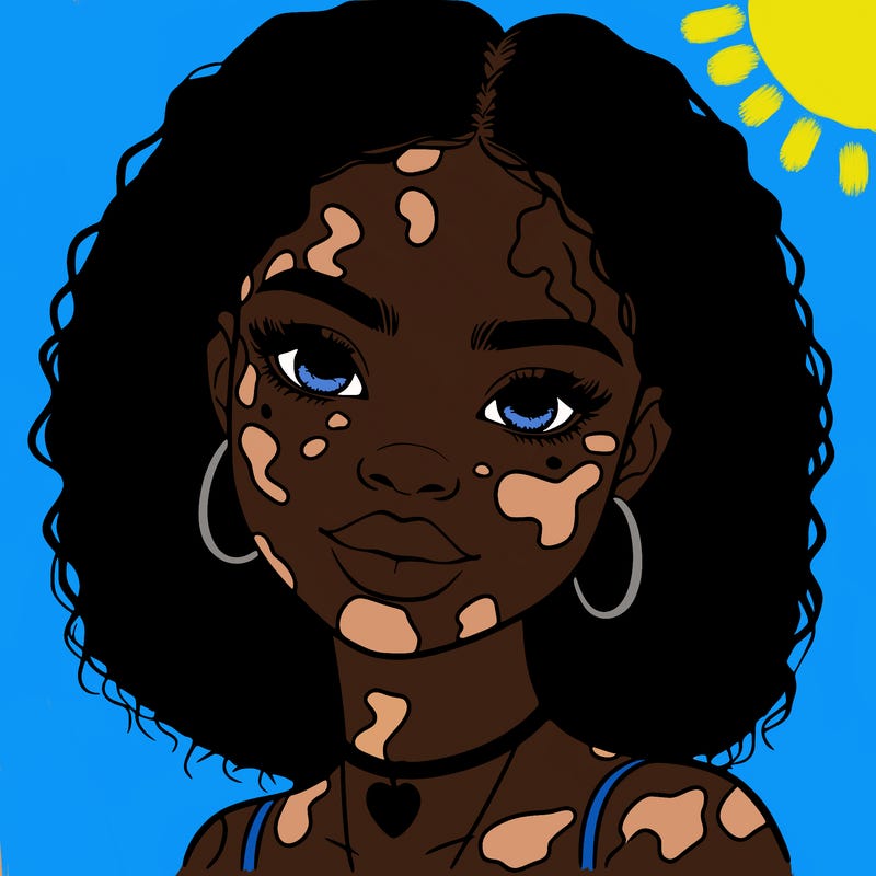 bleautiful black girl with vitiligo
