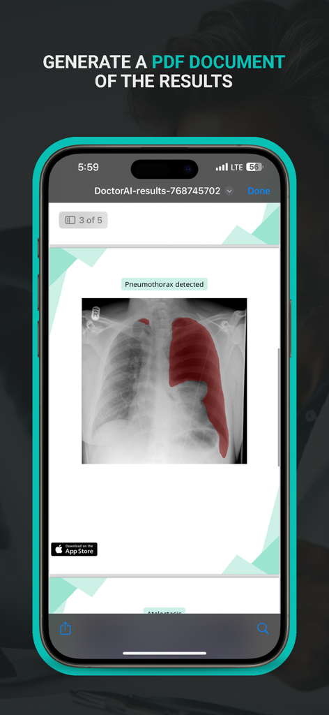 DoctorAI app interface showing a PDF document with chest X-ray analysis results