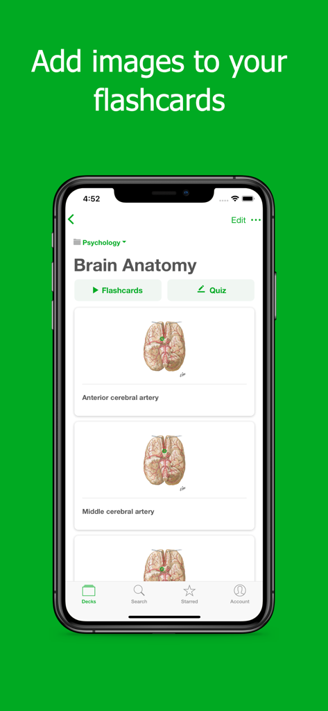 Flashcards Maker Flash Cards - Ein iPhone, das die Flashcards.io-App mit medizinischen Karteikarten zeigt, die Gehirnanatomie-Diagramme enthalten.