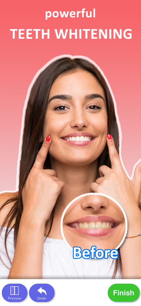 笑顔の女性の歯のホワイトニング前後の比較