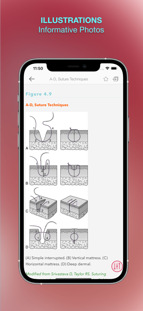 Medical illustrations showing various suture techniques within the Harriet Lane Handbook App interface
