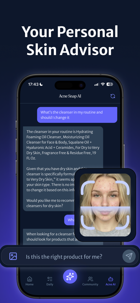 Interface of the Acne Snap app showing an AI skincare assistant and a skin analysis scan