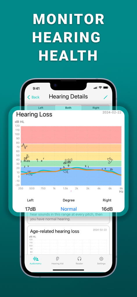 Uma tela de aplicativo móvel exibindo um gráfico de audiograma de perda auditiva usado para monitorar a saúde auditiva.