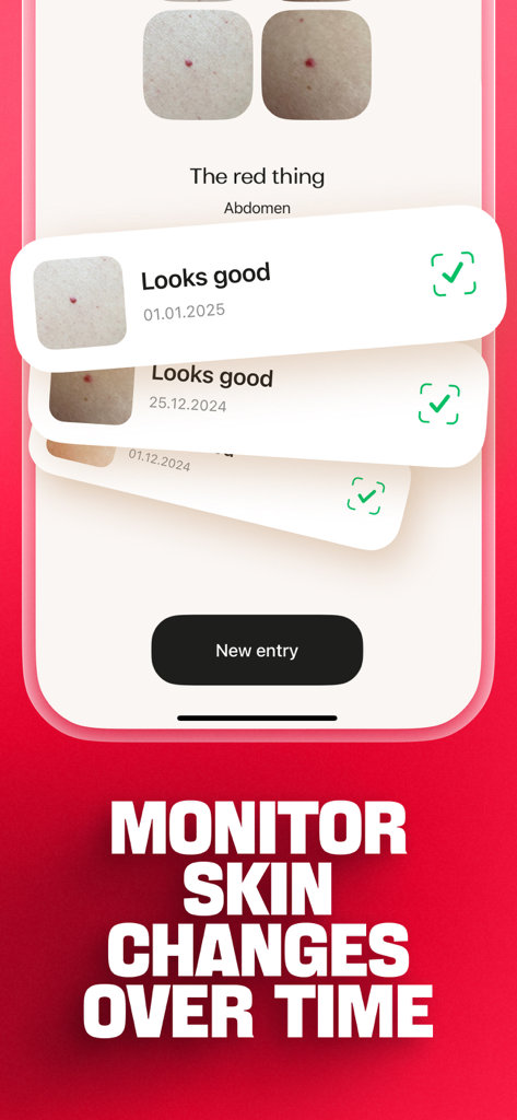 DermaScan - AI dermatologist - Interfaz de aplicación móvil para monitorear cambios en la piel y rastrear el historial de lunares