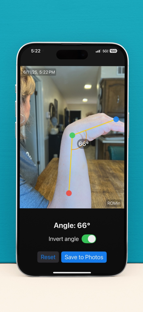 ROMin - Tela do iPhone mostrando o aplicativo ROMin medindo um ângulo de articulação do pulso de 66 graus usando três pontos de referência em uma foto.