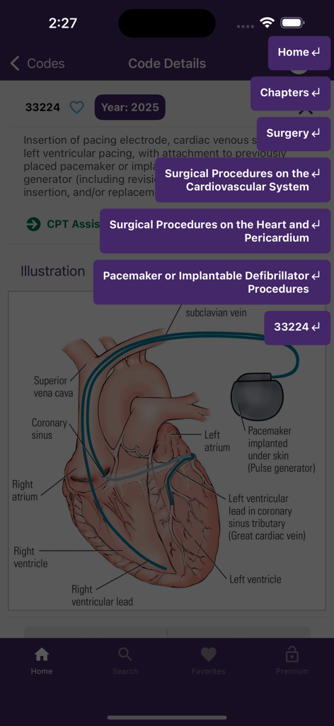 CPT QuickRef - CPT QuickRefアプリ。医療コード33224の詳細と心臓ペースメーカーのイラストが表示されています。