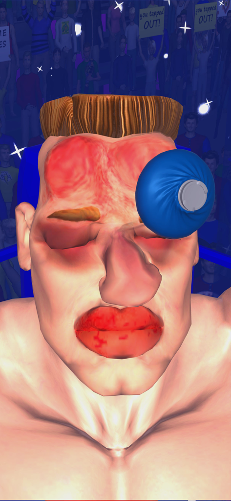 A cartoon boxer with a swollen face and a blue ice pack on his eye