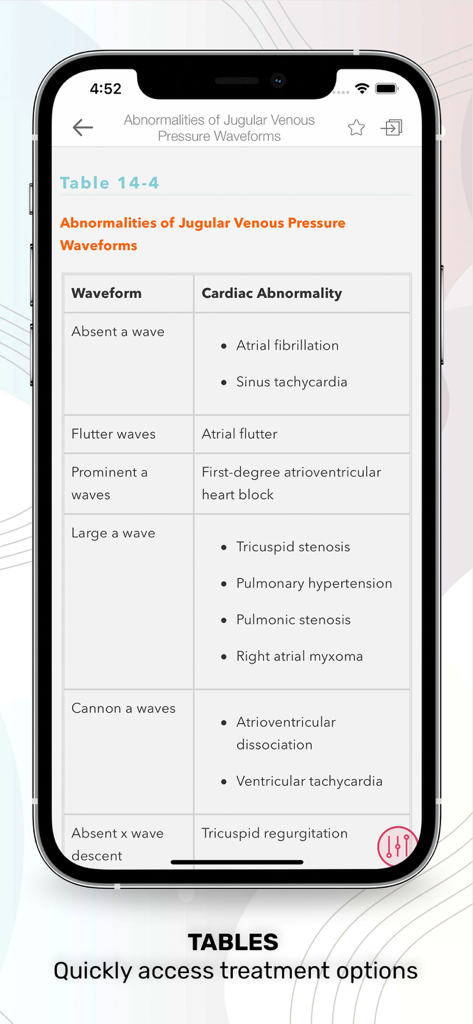 Stoelting Anesthetic Practice - A medical reference table in the Stoelting Anesthetic Practice app showing jugular venous pressure waveforms and cardiac abnormalities