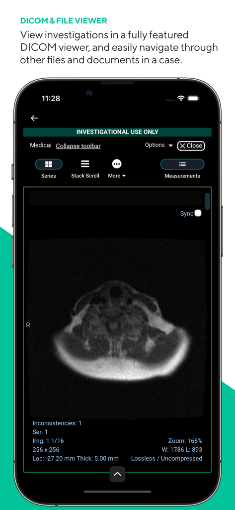 Medicai mobile DICOM viewer showing a medical scan on an iPhone