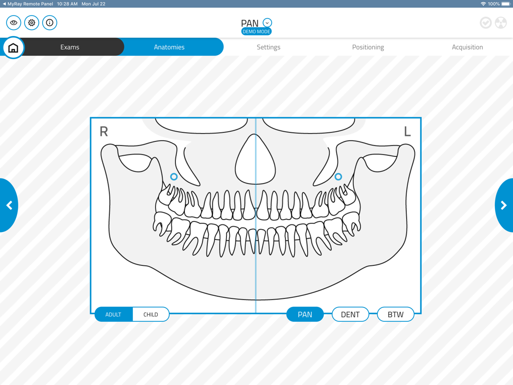 O aplicativo NewTom Control Pad exibindo um diagrama de anatomia odontológica panorâmica para selecionar uma área de exame de raio-X.