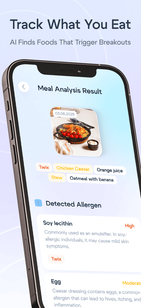 Lumé app interface showing the AI meal scanner results identifying food allergens like soy lecithin that could trigger skin breakouts.