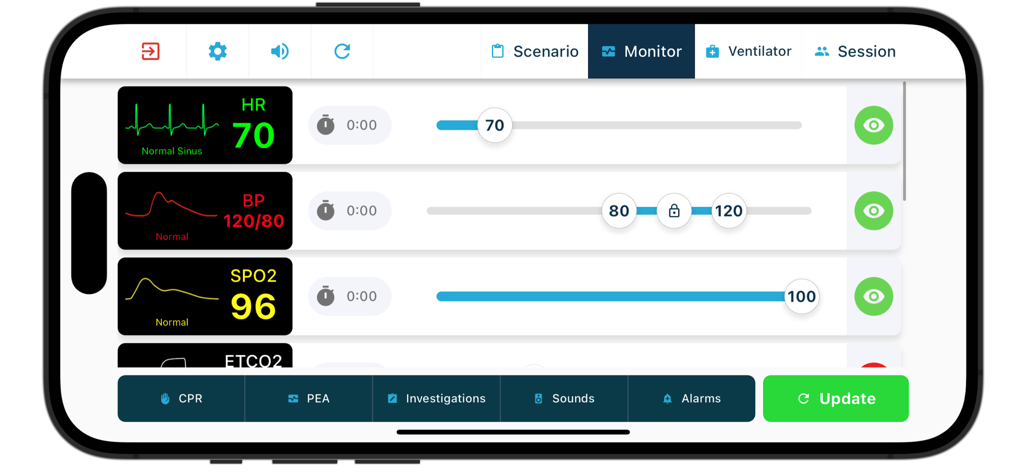 A smartphone screen displaying the TruMonitor medical simulation app interface with adjustable vital sign controls for heart rate, blood pressure, and oxygen saturation.