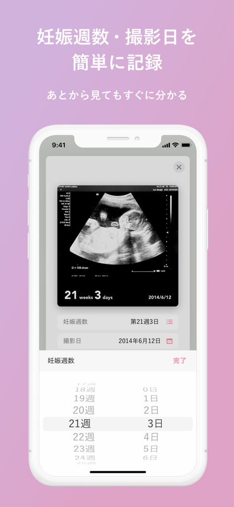エコー写真 - Ultrasound photo app interface showing a scan labeled with pregnancy week 21 and 3 days