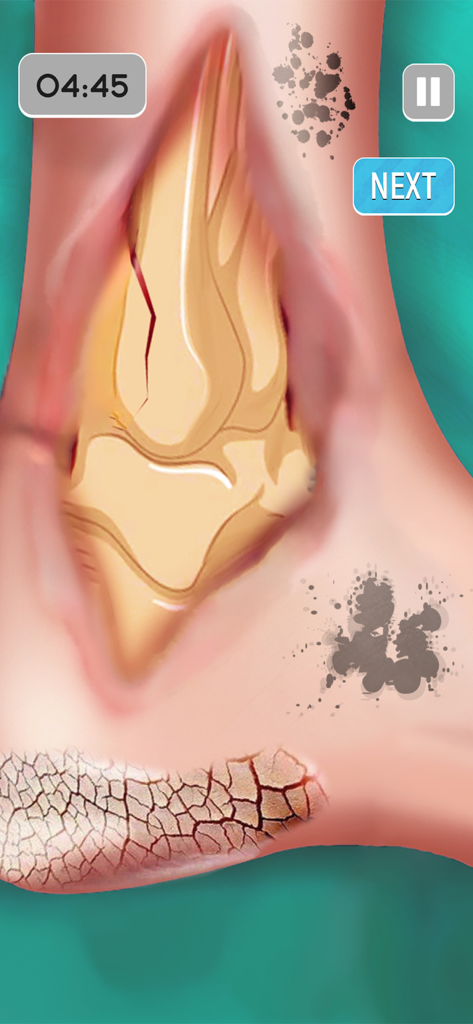 ASMR Foot Care: Doctor Games - A virtual foot treatment simulation in ASMR Foot Care Doctor Games showing wounds and cracked skin care