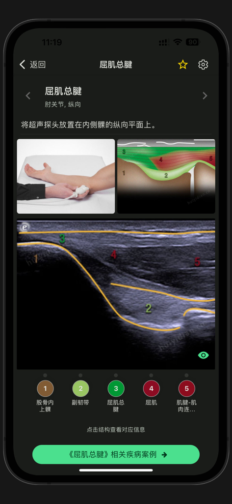 Medical ultrasound learning app interface showing elbow musculoskeletal scan with anatomical labeling and probe placement