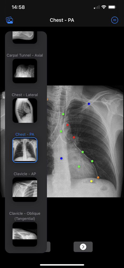 Chest PA X-ray with color coded anatomical markers and a list of radiographic projections
