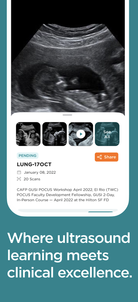 ScanHub by GUSI - Mobile screen of ScanHub app showing an ultrasound scan and project information