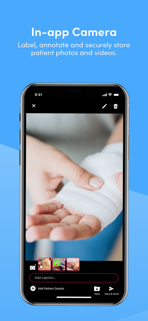 Interface of the Celo app showing the secure in-app camera being used to photograph a patient's bandaged hand