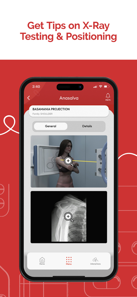ANASALVA - Pantalla de la aplicación Anasalva que muestra consejos de pruebas y posicionamiento de rayos X para una proyección de hombro.