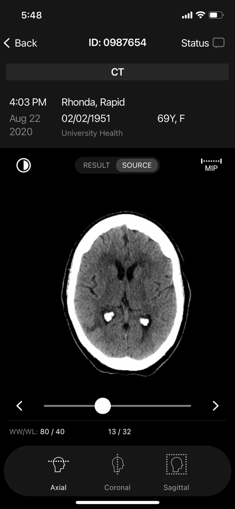 Axial brain CT scan displayed in the RapidAI mobile DICOM viewer