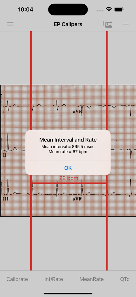 EP Calipers app interface showing mean heart rate and interval results calculated over a digital ECG image