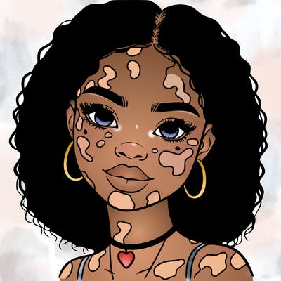 bleautiful black girl with vitiligo