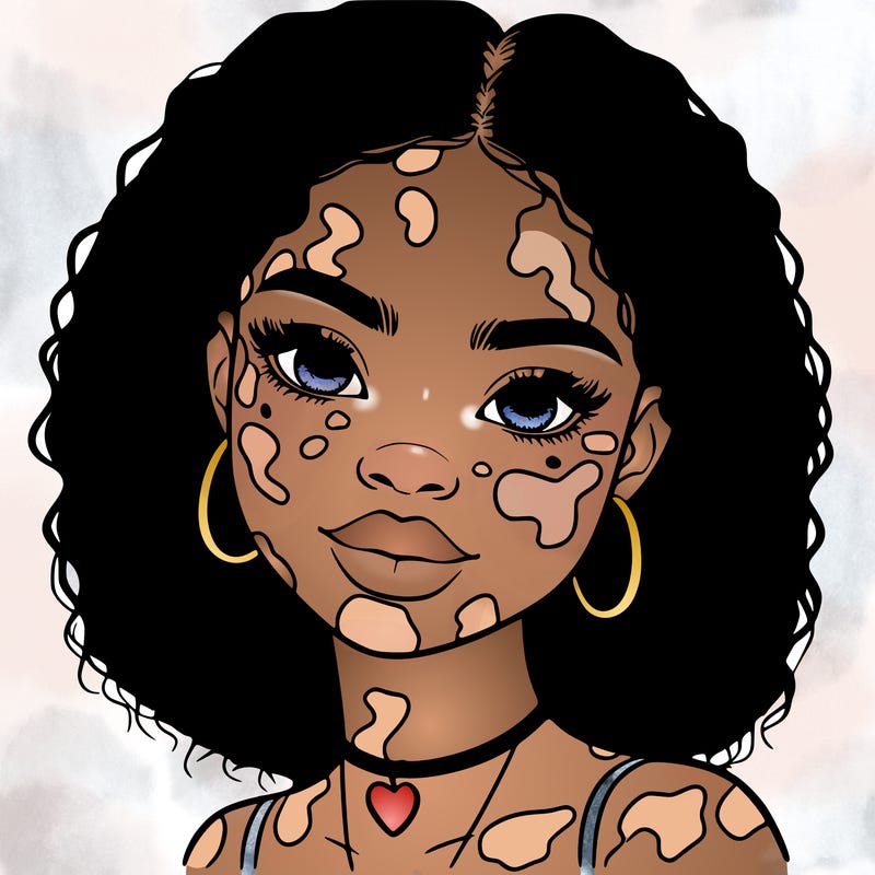bleautiful black girl with vitiligo
