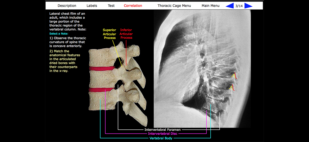 Vista di correlazione clinica che confronta campioni di ossa di vertebre toraciche essiccate con una radiografia laterale del torace