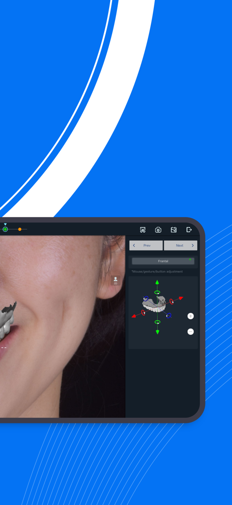 Interfaz de ajuste dental 3D y diseño de sonrisa de Smile Design Pro